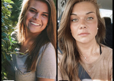 Before After