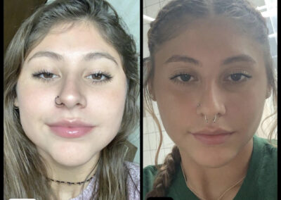 Before After