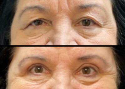 Before After