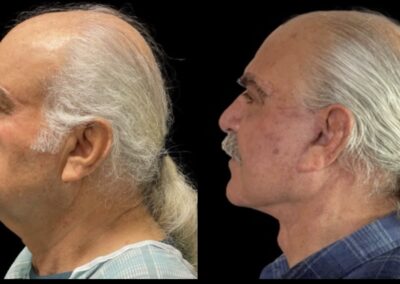 Before After