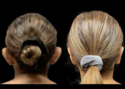 Before After