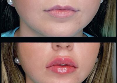 Before After