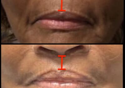 Before After