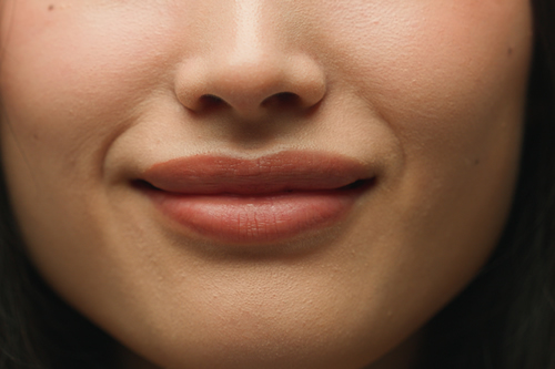 Buccal Fat Reduction